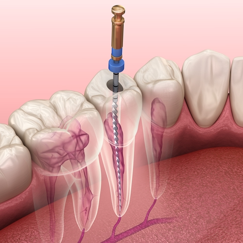 Endodontia